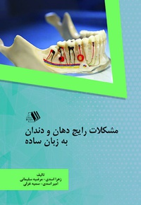 مشکلات رایج دهان و دندان به زبان ساده